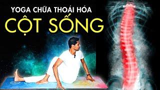 Các Bài Tập Yoga Tốt Nhất cho Chứng Vẹo Cột Sống | Yoga chữa Bệnh Cột Sống