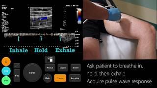 Ultrasound Tutorial: DVT / Lower Limb Veins | Radiology Nation