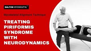 Treating Piriformis Syndrome with Neurodynamics | ErikDalton.com