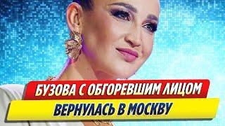 Бузова с обгоревшим лицом вернулась в Москву из отпуска