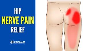 How to INSTANTLY Fix Nerve Pain in Your Hip