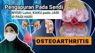 SENDI BENGKAK dan KAKU saat BANGUN TIDUR -mungkin kamu mengalami OSTEOARTHRITIS