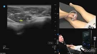 Ultrasound Evaluation of the Posterior Knee