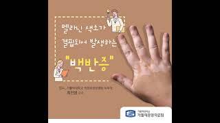 [가톨릭중앙의료원 건강매거진]멜라닌 색소가 결핍되어 발생하는 “백반증”