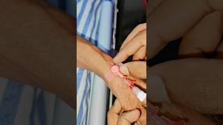 IV canula line procedure #doctor #medical technology #short #viral