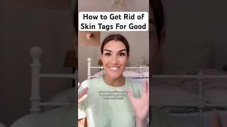 How to Shrink Skin Tags (so they never come back!)