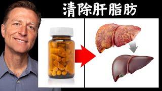 清除脂肪肝, 最好維他命膽鹼choline,自然療法,柏格醫生 Dr Berg