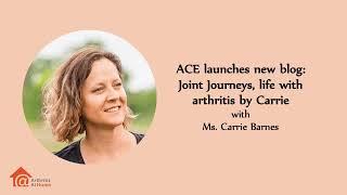 Arthritis At Home Episode 174 – ACE launches new blog: Joint Journeys, life with arthritis by Carrie