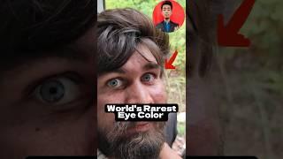 World's Rarest Eye Colors