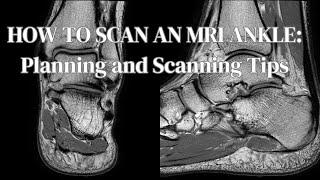 MRI Ankle Scan