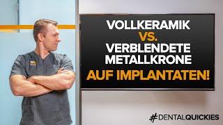 Was ist besser: Vollkeramikkrone oder Metallverblendkrone auf Implantaten? Wir klären auf!