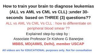 How to diagnose #leukaemias on #peripheralbloodsmear :under 30-seconds? #med #medstudent #mbbs #md