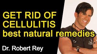 GET RID OF CELLULITIS - BEST HOME REMEDIES - Dr. Rey