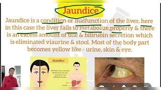 Jaundice ll Definition in Hindi ll Causes and Symptoms ll @SG Pharma Dictionary1M