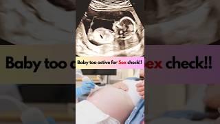 Baby Kicks  Boy or Gir  #baby #ultrasoundscans #fetus