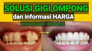 GIGI OMPONG: solusi dan perkiraan biaya