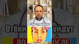 Отёки на лице как убрать #здоровье #медицина #доктордешевин #здоровыйобразжизни