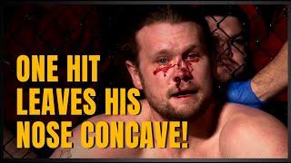 MASSIVE HAYMAKER SHATTERS OPPONENTS NOSE!  Ryan Gunderson vs Sean Matheney
