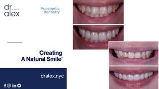 How I Create Smiles - Dr. Alex Rubinov - Cosmetic Dentist in NYC