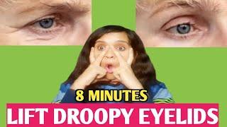 8 MinFace Yoga ExerciseTo Get Rid Of Droopy Eyelids ! Remove Dark Circles & Wrinkles