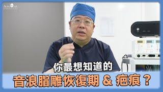 抽脂 專業分享: 你最想知道的音浪脂雕 恢復期 & 音浪脂雕 抽脂切口