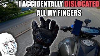 HOW I ACCIDENTALLY DISLOCATED ALL MY FINGERS AT ONCE (WHILE DRIVING!!!)