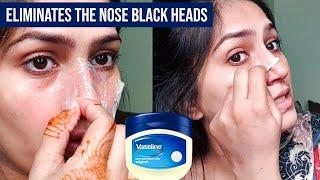 Will Vaseline & Cleansing Oil Eliminates The Nose Black Heads | Natasha waqas