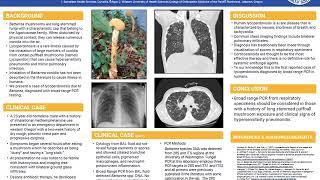 Hypersensitivity Pneumonitis Diagnosed with PCR Testing after Exposure to Battarrea Mushroom Spores