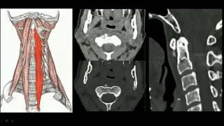 Rx da coluna cervical