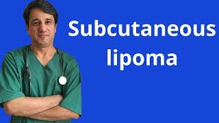 Subcutaneous lipoma