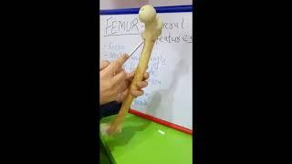 FEMUR - GENERAL FEATURES BY DR MITESH DAVE