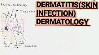 Dermatitis Infection Response