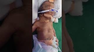 Born Early, Loved Fully 