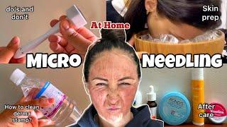 How to Use DERMA STAMP At Home| How to clean derma stamp ? | Skin prep & After care 