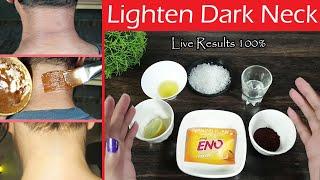 Get Rid of Dark Neck Easily at Home, Lighten Black Neck Fast