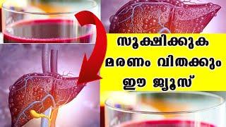 സൂക്ഷിക്കുക !മരണം വിതക്കും ഈ ജ്യൂസ് !നിങ്ങൾ അറിയേണ്ടത് /Dr Manoj Johnson