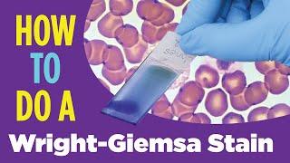 How to do a hematology stain (Wright-Giemsa stain) Laboratory Tutorial Procedure