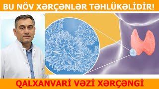 Qalxanvari vəzi  xərçəngləri arasında ən təhlükəli növ BUDUR!!! Dr.Sadiq Bəbirov