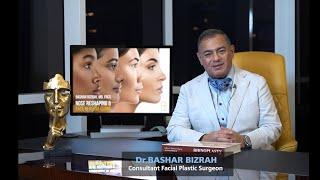 Rhinoplasty Bizrah Academy | Dr Bashar Bizrah MD, FRCS (ORL) Consultant ENT & Facial Plastic Surgeon