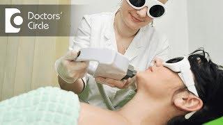 What is photofacial? - Dr. Amee Daxini