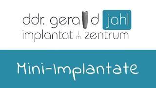 Mini-Implantate, eine große Hilfe für Senioren!