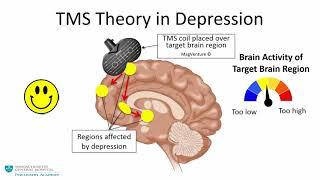 Transcranial Magnetic Stimulation: A New Treatment Approach for Psychiatric Disorders