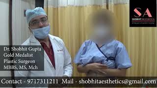 Mini Tummy Tuck | Dr.Shobhit Gupta #mini #tummytuck #marking #explanation #abdominoplasty #procedure