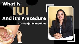 What is IUI And it’s Procedure | Dr.Kaajal Mangukiya Best Gynecologist in Surat