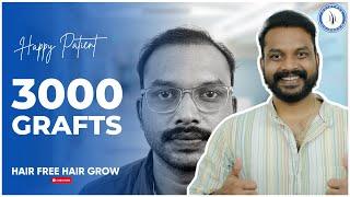 Hair Transplant in Surat || Best Results & Cost of Hair Transplant in Surat Gujarat