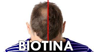 BIOTINA para el PELO explicado por MÉDICO: ¿FUNCIONA?