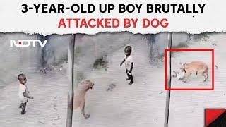 Dog Attack Baby | 3-year-Old UP Boy Brutally Attacked By Dog, Hospitalised