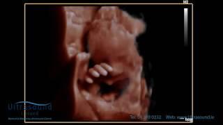 Scan of the Week: 28 week baby waving hello during our 3D/4D Ultrasound