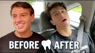 Brennan's *HILARIOUS* Wisdom Tooth Removal Reaction " WHY WOULD THEY DO THAT??"