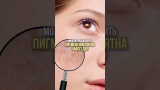Можно ли удалить пигментные пятна навсегда? #косметолог #skincare #уходзалицом #красота #пигментация
